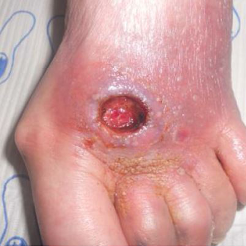 Diabetic-Would-Before